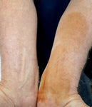 Dihydroxyacetone (DHA)